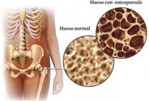 los huesos