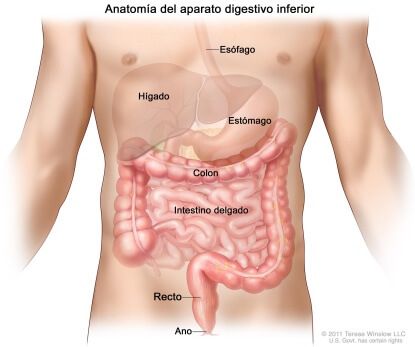 cancer de colon